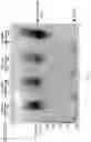 Fig. 20 - Methods of treating IgA nephropathy with thiol-containing molecules