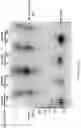Fig. 21 - Methods of treating IgA nephropathy with thiol-containing molecules
