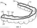 Fig. 02 - ANTIMICROBIAL DENTAL APPLIANCE