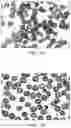 Fig. 08 - DOSING REGIMENS FOR 2-HYDROXY-6-((2-(1-ISOPROPYL-1H-PYRAZOL-5-YL)PYRIDIN-3-YL)METHOXY)BENZALDEHYDE