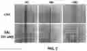 Fig. 04 - Composition containing salsolinol for treating liver cancer