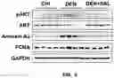Fig. 11 - Composition containing salsolinol for treating liver cancer