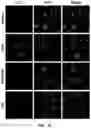 Fig. 12 - Composition containing salsolinol for treating liver cancer