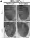 Fig. 01 - PHARMACEUTICAL COMPOSITION FOR TREATMENT OF NEURODEGENERATIVE DISEASES OR DISEASES CAUSED BY ABNORMALITY OF RNA BINDING PROTEIN AND APPLICATIONS THEREOF