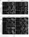 Fig. 02 - PHARMACEUTICAL COMPOSITION FOR TREATMENT OF NEURODEGENERATIVE DISEASES OR DISEASES CAUSED BY ABNORMALITY OF RNA BINDING PROTEIN AND APPLICATIONS THEREOF