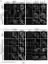 Fig. 03 - PHARMACEUTICAL COMPOSITION FOR TREATMENT OF NEURODEGENERATIVE DISEASES OR DISEASES CAUSED BY ABNORMALITY OF RNA BINDING PROTEIN AND APPLICATIONS THEREOF