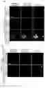 Fig. 05 - PHARMACEUTICAL COMPOSITION FOR TREATMENT OF NEURODEGENERATIVE DISEASES OR DISEASES CAUSED BY ABNORMALITY OF RNA BINDING PROTEIN AND APPLICATIONS THEREOF