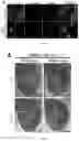 Fig. 06 - PHARMACEUTICAL COMPOSITION FOR TREATMENT OF NEURODEGENERATIVE DISEASES OR DISEASES CAUSED BY ABNORMALITY OF RNA BINDING PROTEIN AND APPLICATIONS THEREOF
