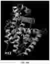 Fig. 13 - GERM CELL NUCLEAR FACTOR LIGANDS AND METHODS OF USE THEREOF