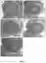 Fig. 02 - METHODS AND COMPOSITIONS FOR TREATING HUMAN PAPILLOMAVIRUS (HPV)-INDUCED CANCERS