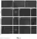 Fig. 04 - METHODS AND COMPOSITIONS FOR TREATING HUMAN PAPILLOMAVIRUS (HPV)-INDUCED CANCERS