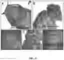 Fig. 06 - METHODS AND COMPOSITIONS FOR TREATING HUMAN PAPILLOMAVIRUS (HPV)-INDUCED CANCERS