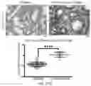 Fig. 45 - REVERSE TRANSCRIPTASE BLOCKING AGENTS AND METHODS OF USING THE SAME