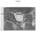 Fig. 02 - METHODS AND COMPOSITIONS TO FACILITATE REPAIR OF AVASCULAR TISSUE