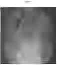 Fig. 05 - METHODS AND COMPOSITIONS TO FACILITATE REPAIR OF AVASCULAR TISSUE