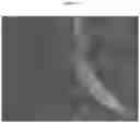 Fig. 09 - METHODS AND COMPOSITIONS TO FACILITATE REPAIR OF AVASCULAR TISSUE