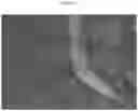 Fig. 11 - METHODS AND COMPOSITIONS TO FACILITATE REPAIR OF AVASCULAR TISSUE