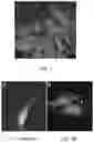 Fig. 02 - PRIMED MUSCLE PROGENITOR CELLS AND USES THEREOF