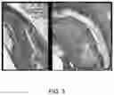 Fig. 03 - PRIMED MUSCLE PROGENITOR CELLS AND USES THEREOF
