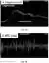 Fig. 04 - PRIMED MUSCLE PROGENITOR CELLS AND USES THEREOF