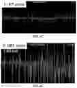 Fig. 05 - PRIMED MUSCLE PROGENITOR CELLS AND USES THEREOF