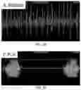 Fig. 06 - PRIMED MUSCLE PROGENITOR CELLS AND USES THEREOF