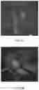 Fig. 07 - PRIMED MUSCLE PROGENITOR CELLS AND USES THEREOF