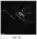 Fig. 11 - PRIMED MUSCLE PROGENITOR CELLS AND USES THEREOF