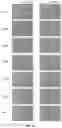 Fig. 03 - PSEUDORABIES VIRUS FOR TREATING TUMORS
