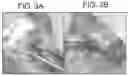Fig. 04 - Modulation of heparin-binding epidermal growth factor activity for tympanic membrane healing