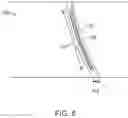 Fig. 09 - Modulation of heparin-binding epidermal growth factor activity for tympanic membrane healing