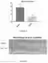 Fig. 03 - Application of FGF21 in preparation of medicine for treating colorectal cancer