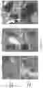 Fig. 34 - Method and compounds for treating diabetes and associated metabolic diseases