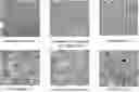 Fig. 01 - METHODS OF PROMOTING REMYELINATION