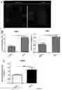 Fig. 08 - COMPOUND DECREASING THE CONCENTRATION OF 2-HYDROXY-GLUTARATE