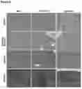 Fig. 06 - PEPTIDES WITH ANTI-TUMOR ACTIVITY