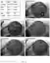 Fig. 02 - COMPOSITIONS AND METHODS FOR INHIBITING YEAST INFECTIONS
