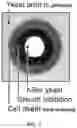 Fig. 04 - COMPOSITIONS AND METHODS FOR INHIBITING YEAST INFECTIONS
