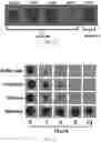 Fig. 32 - COMPOSITIONS AND METHODS FOR INHIBITING YEAST INFECTIONS