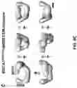 Fig. 17 - BRCA1 MODULATING COMPOUNDS, FORMULATIONS THEREOF, AND USES THEREOF
