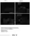 Fig. 04 - POLYMERIC NANOVACCINES AND USES THEREOF