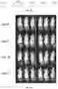Fig. 05 - WHOLE CELL TUMOR VACCINES AND METHODS OF USE THEROF