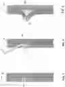 Fig. 02 - Devices and methods and agent-assisted medical procedures