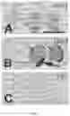 Fig. 03 - LIVER SPECIFIC DELIVERY OF MESSENGER RNA