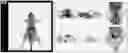 Fig. 01 - COMPOSITION FOR TARGETING MEDULLARY THYROID CANCER