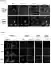 Fig. 02 - COMPOSITION FOR TARGETING MEDULLARY THYROID CANCER