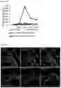 Fig. 07 - COMPOSITION FOR TARGETING MEDULLARY THYROID CANCER