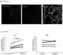 Fig. 08 - COMPOSITION FOR TARGETING MEDULLARY THYROID CANCER