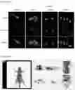Fig. 13 - COMPOSITION FOR TARGETING MEDULLARY THYROID CANCER