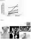Fig. 14 - COMPOSITION FOR TARGETING MEDULLARY THYROID CANCER